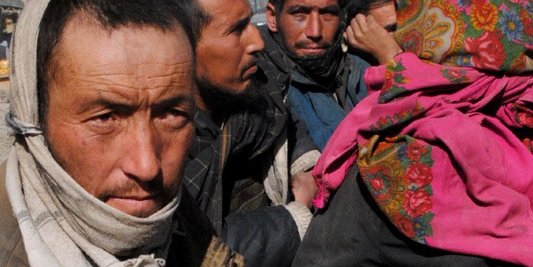 کابل از لنز دوربین