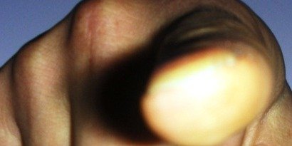 آیا جامعه ی جهانی به نتیجه ای می رسد که داکتر بشردوست شش سال پیش رسید؟